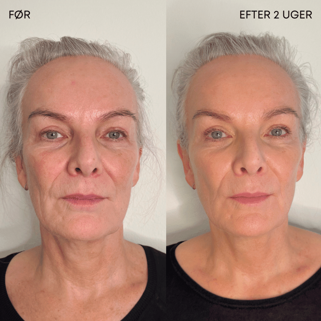 kosmetisk klinik Brønshøj