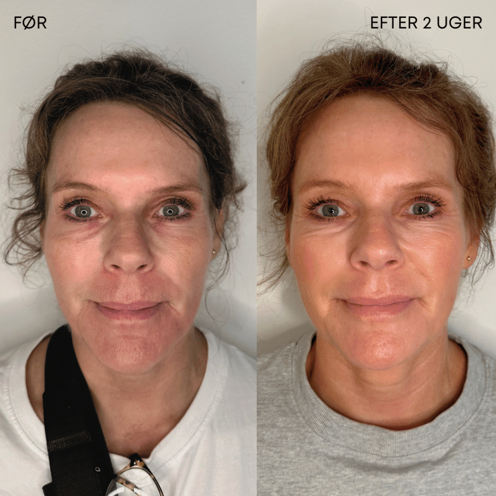 kosmetisk klinik Brønshøj