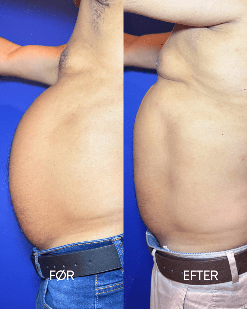 kosmetisk klinik Brønshøj