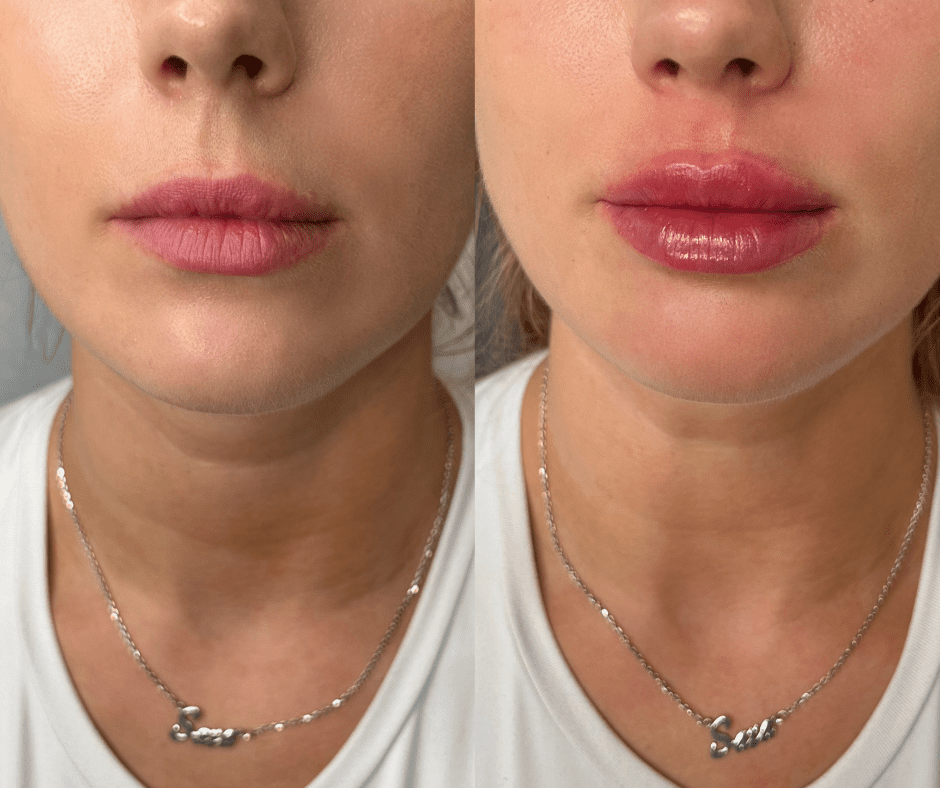 kosmetisk klinik i brønshøj